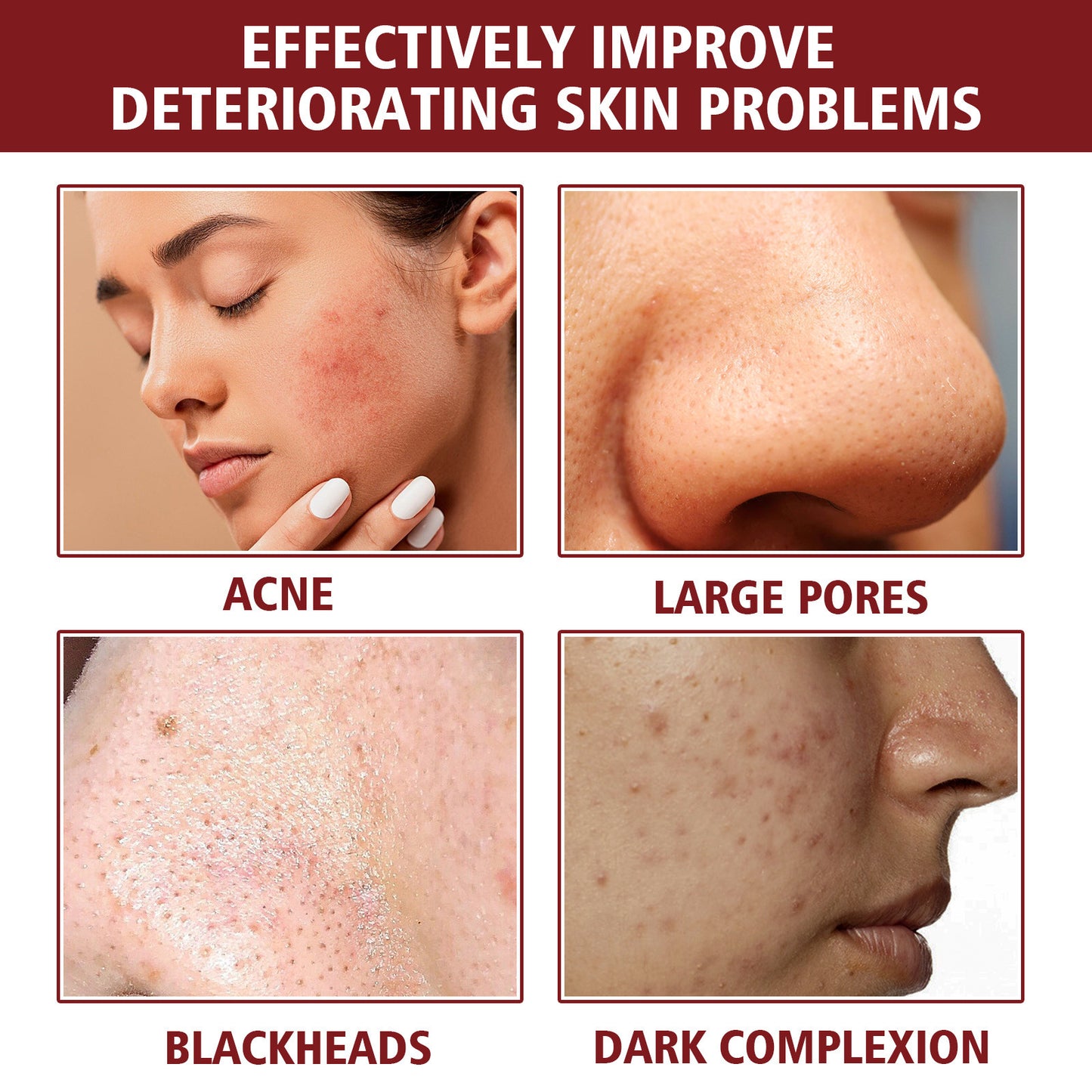 Facial Toner for Moisturizing And Softening Skin and Fading Spots - Blessed Corner