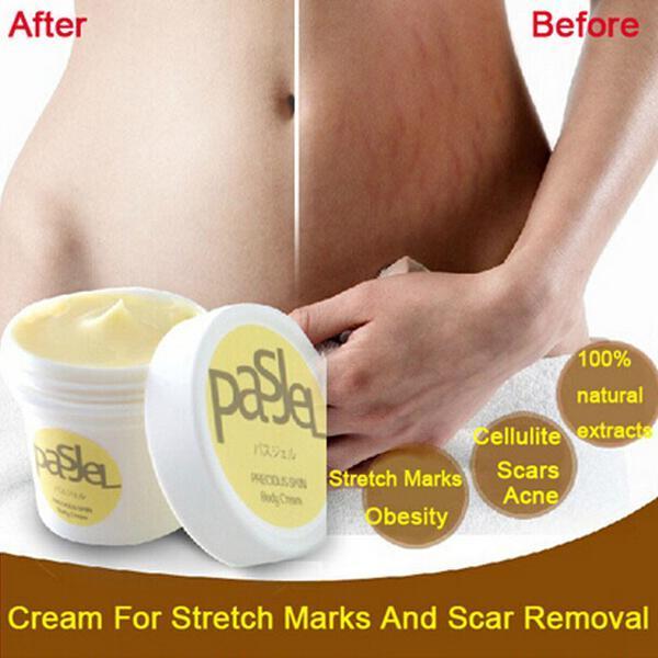 Scar & Stretch Mark Removal Cream - Blessed Corner