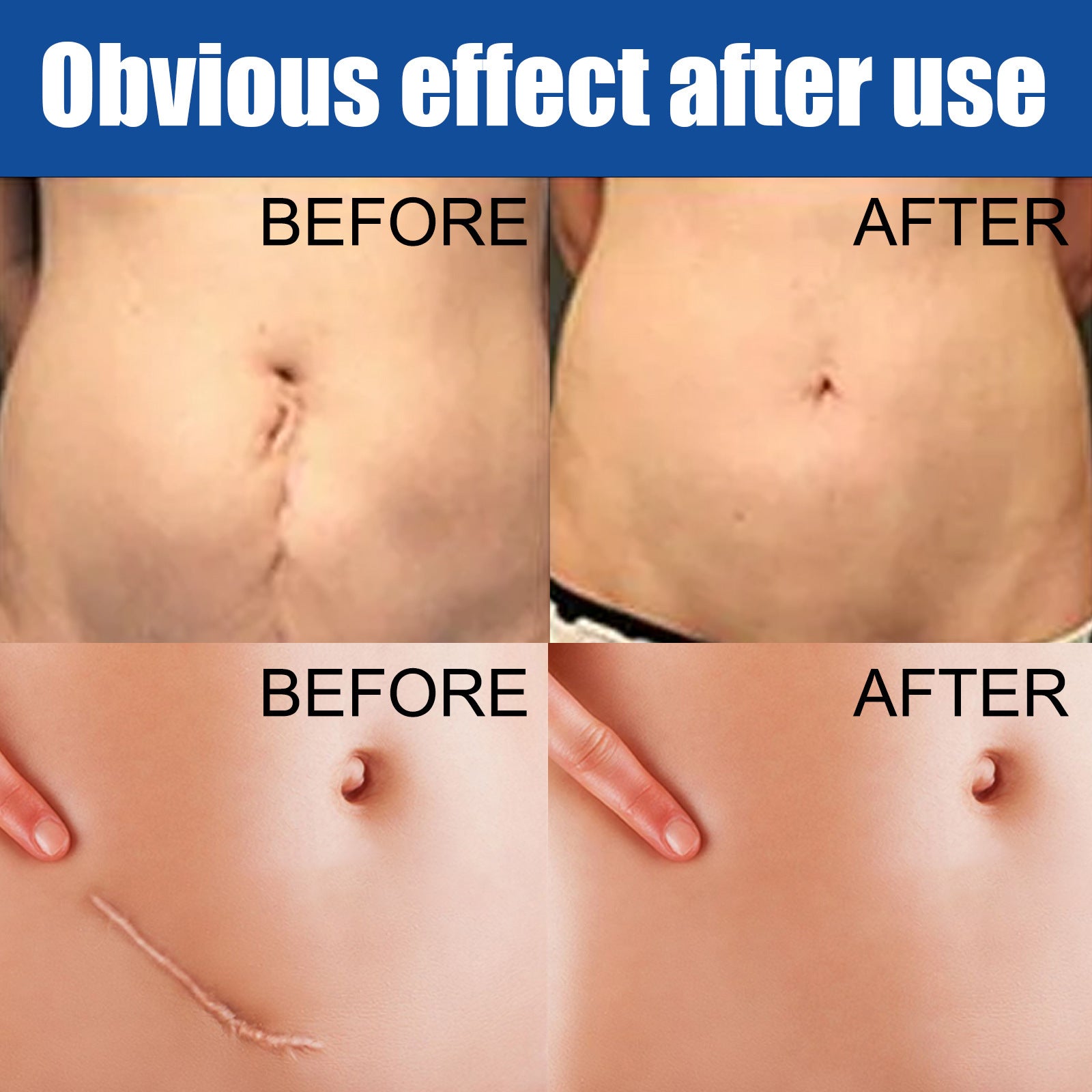 All Natural Scar repairing cream - Blessed Corner