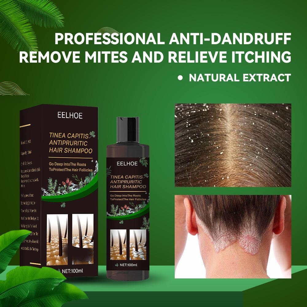 Anti-Dandruff Shampoo - Itch Relief, Hair Loss Prevention, Oil Control & Refreshing Care - Blessed Corner