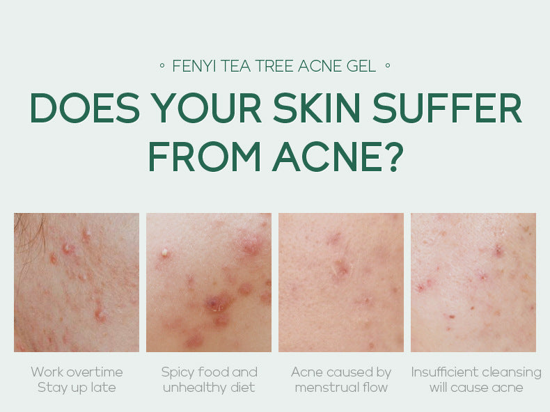 Fenyi Tea Tree Acne Gel - Blessed Corner