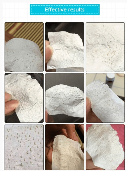 Blackhead Nasal Membrane, acne T area care – 60 Sheets - Blessed Corner