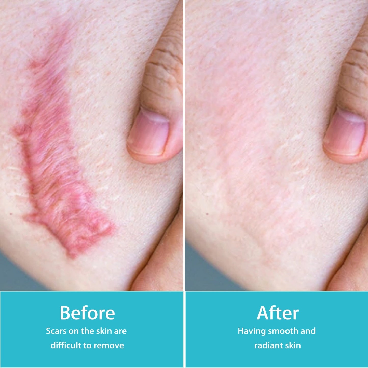 Advanced Scar Fading Spray - Blessed Corner