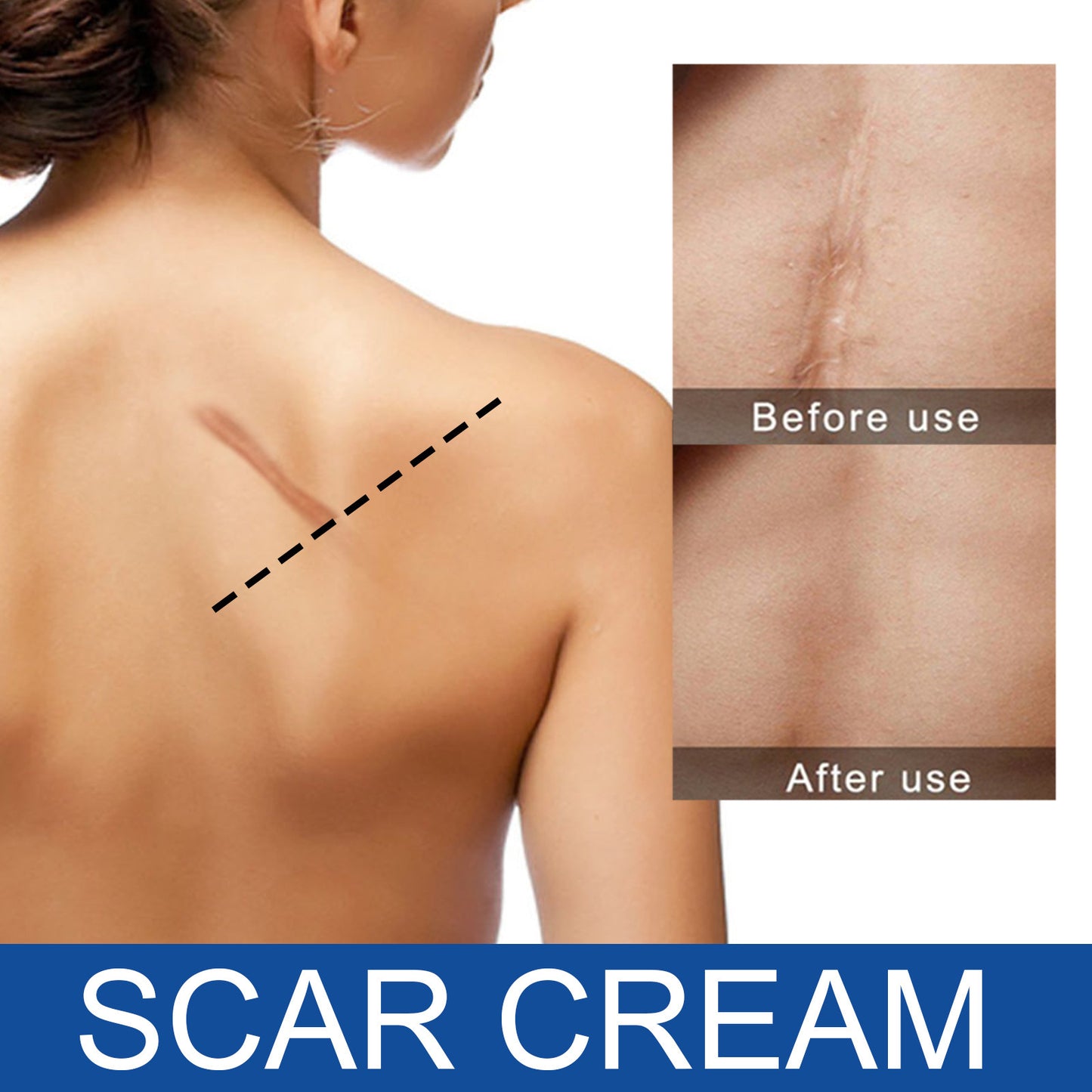 All Natural Scar repairing cream - Blessed Corner