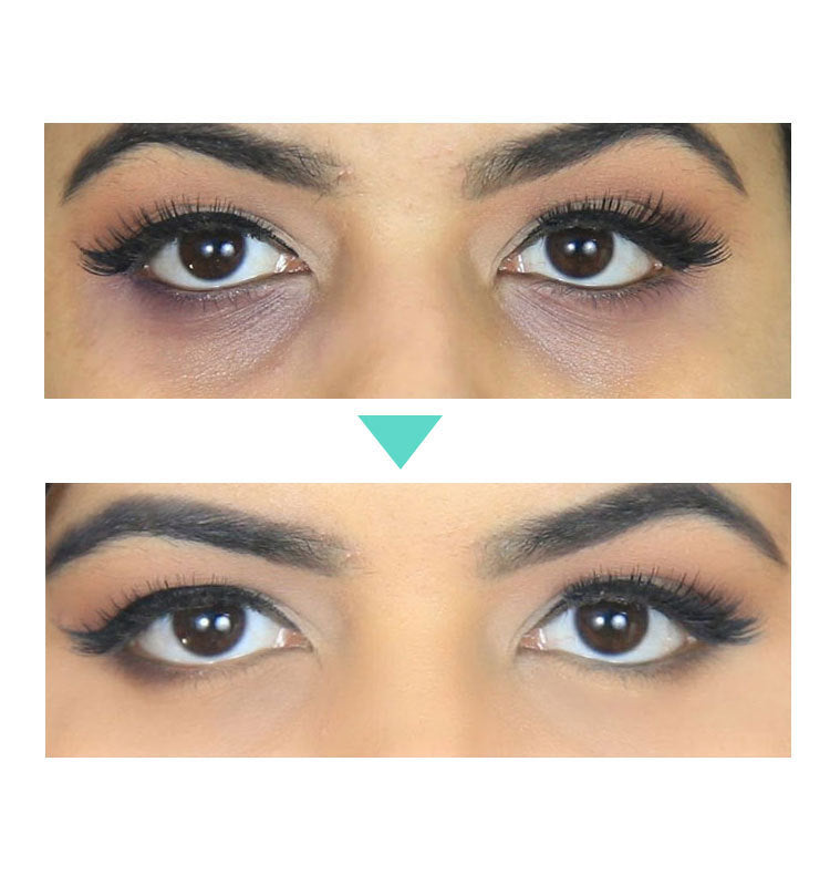 Beauty Eye Cream for Women & Men, clears dark circles and wrinkles. - Blessed Corner