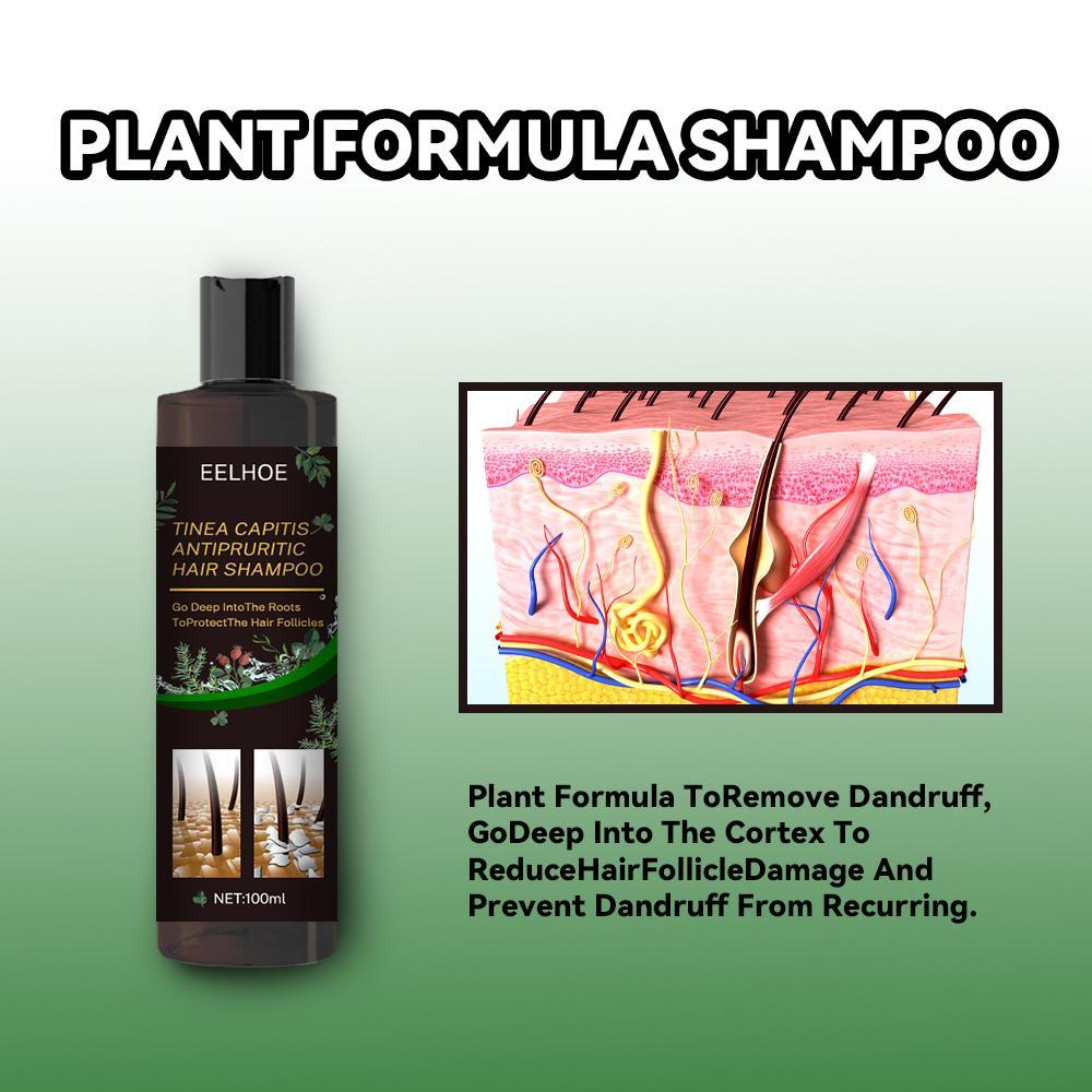 Anti-Dandruff Shampoo - Itch Relief, Hair Loss Prevention, Oil Control & Refreshing Care - Blessed Corner