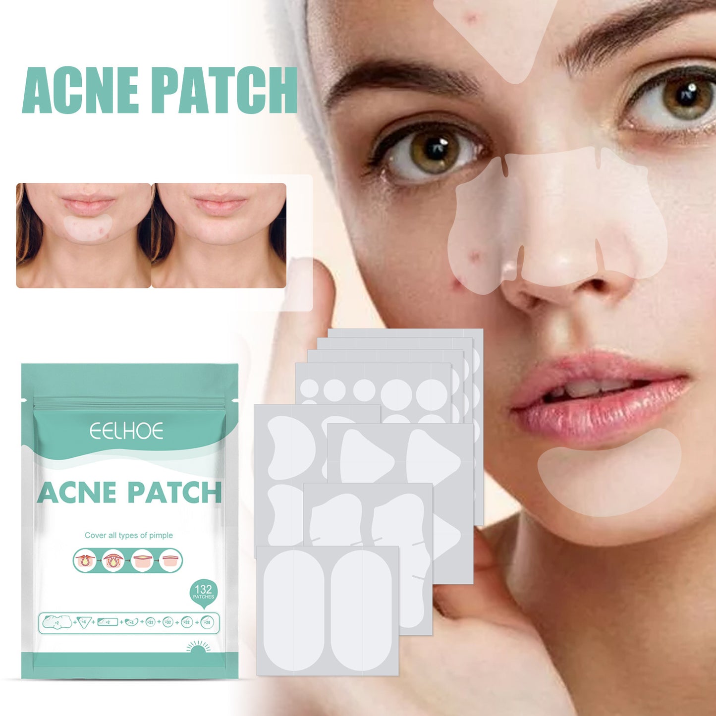 Acne Relief Mask Patch contains tea tree, calendula oil - Blessed Corner