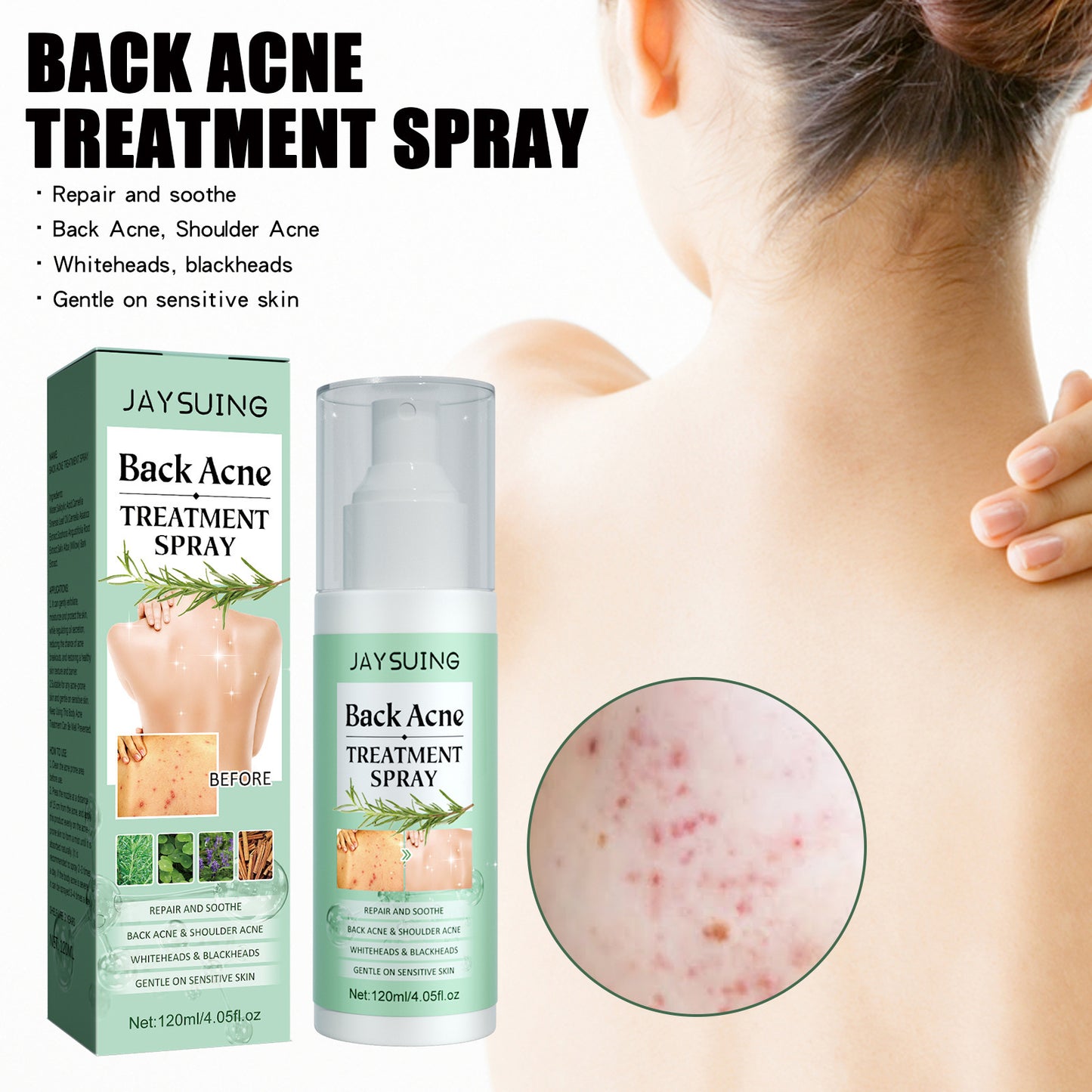 Back & Shoulder Acne Repair Spray - Blessed Corner