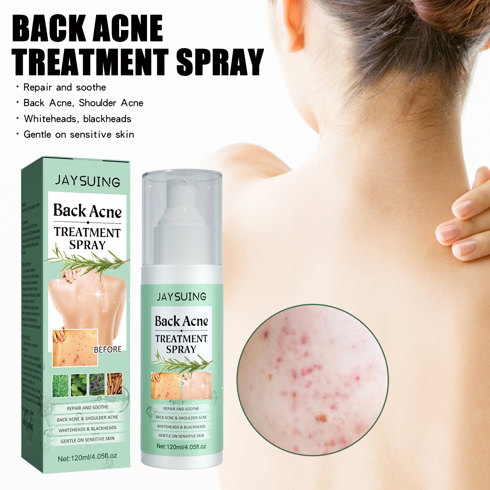 Back & Shoulder Acne Repair Spray - Blessed Corner