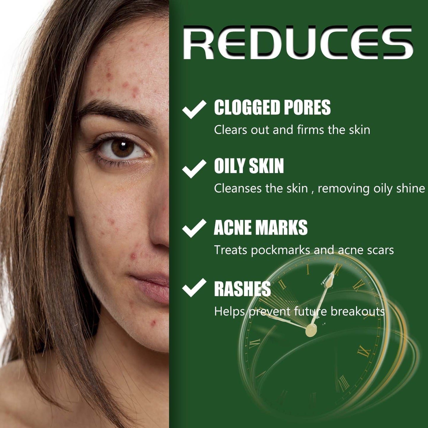 Skin Repair Cream – Clean Acne Care - Blessed Corner