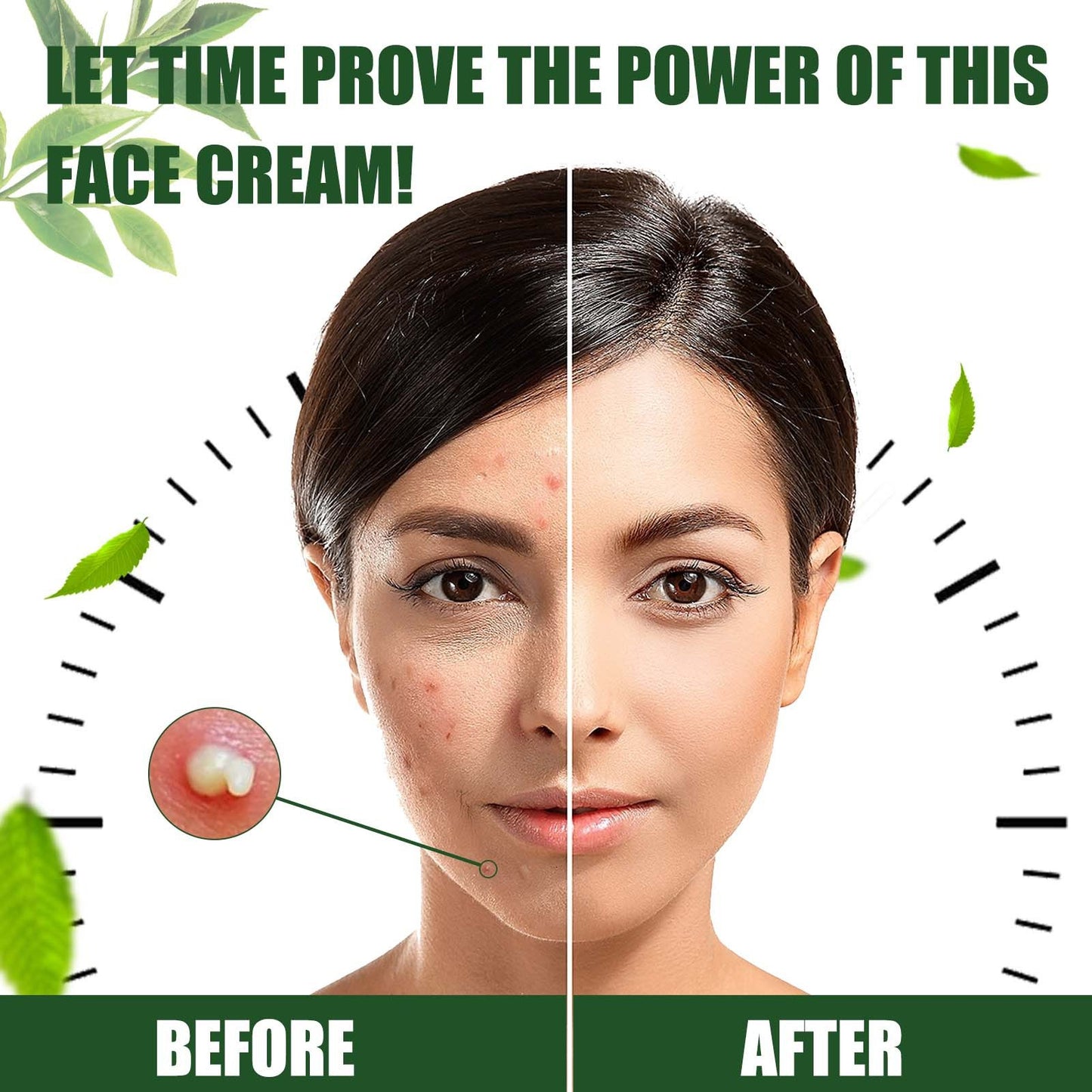 Skin Repair Cream – Clean Acne Care - Blessed Corner
