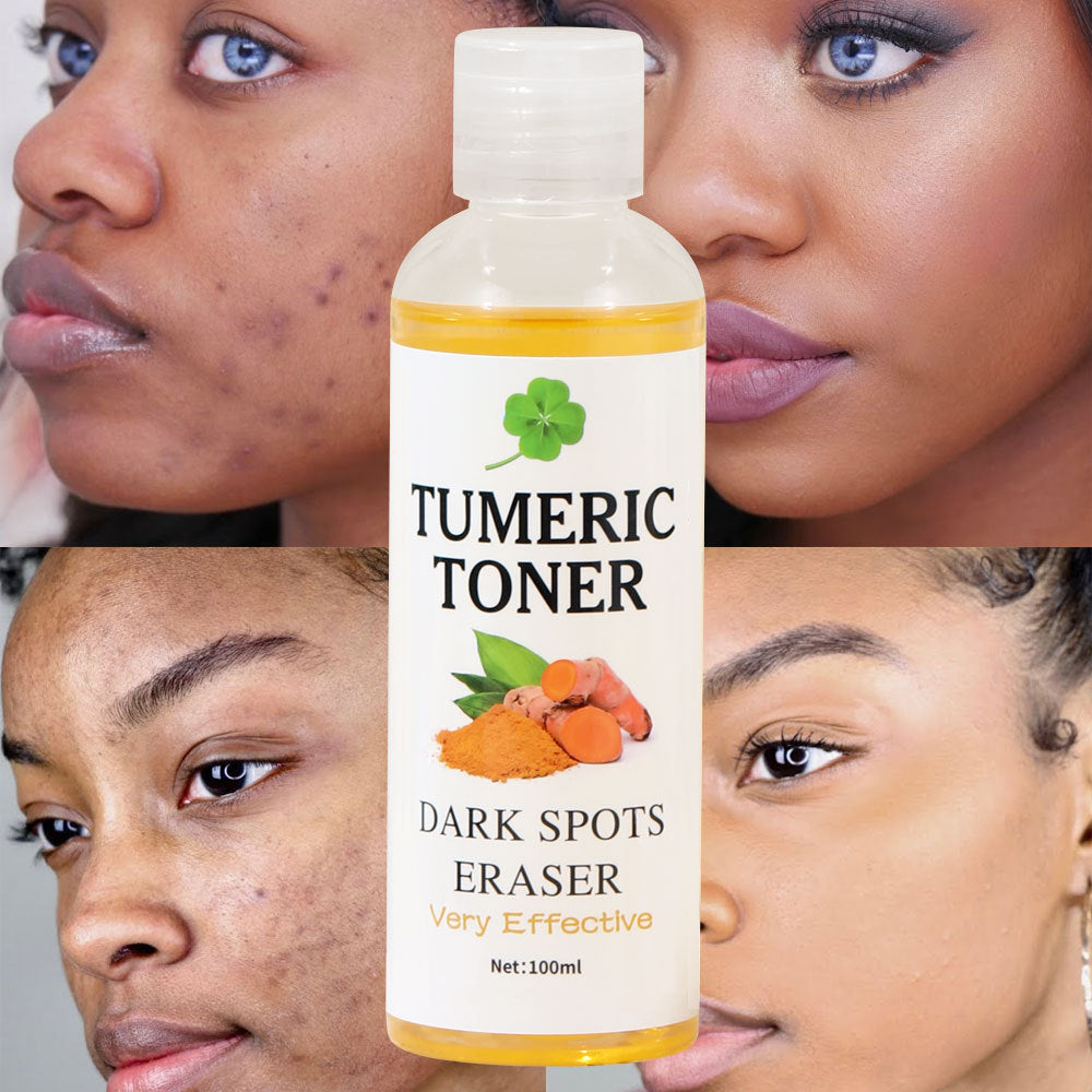 Dark Spot Eraser Turmeric Softening Toner Lotion - Blessed Corner