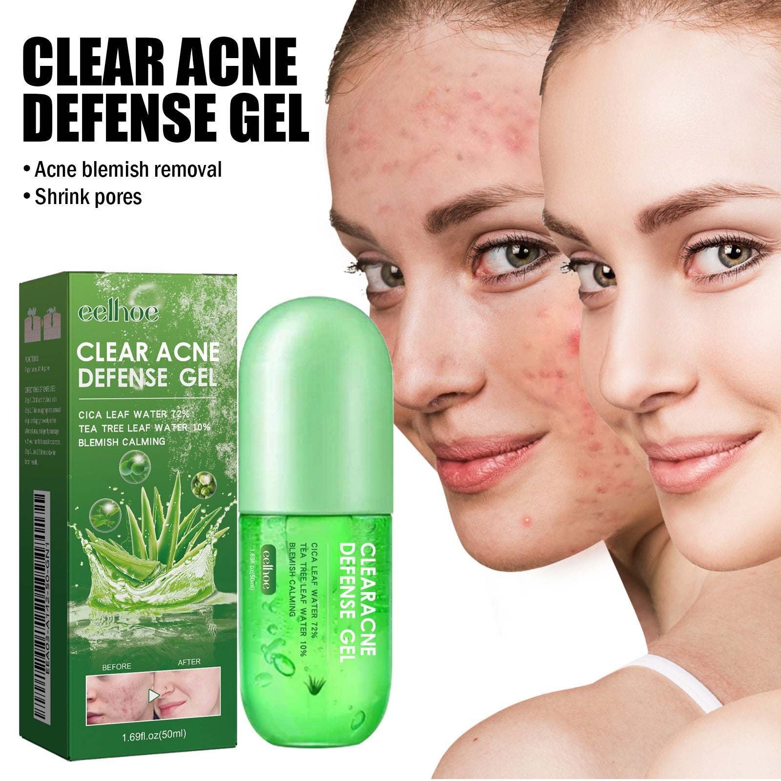 Acne Care Gel – Soothing Relief for Clearer Skin - Blessed Corner