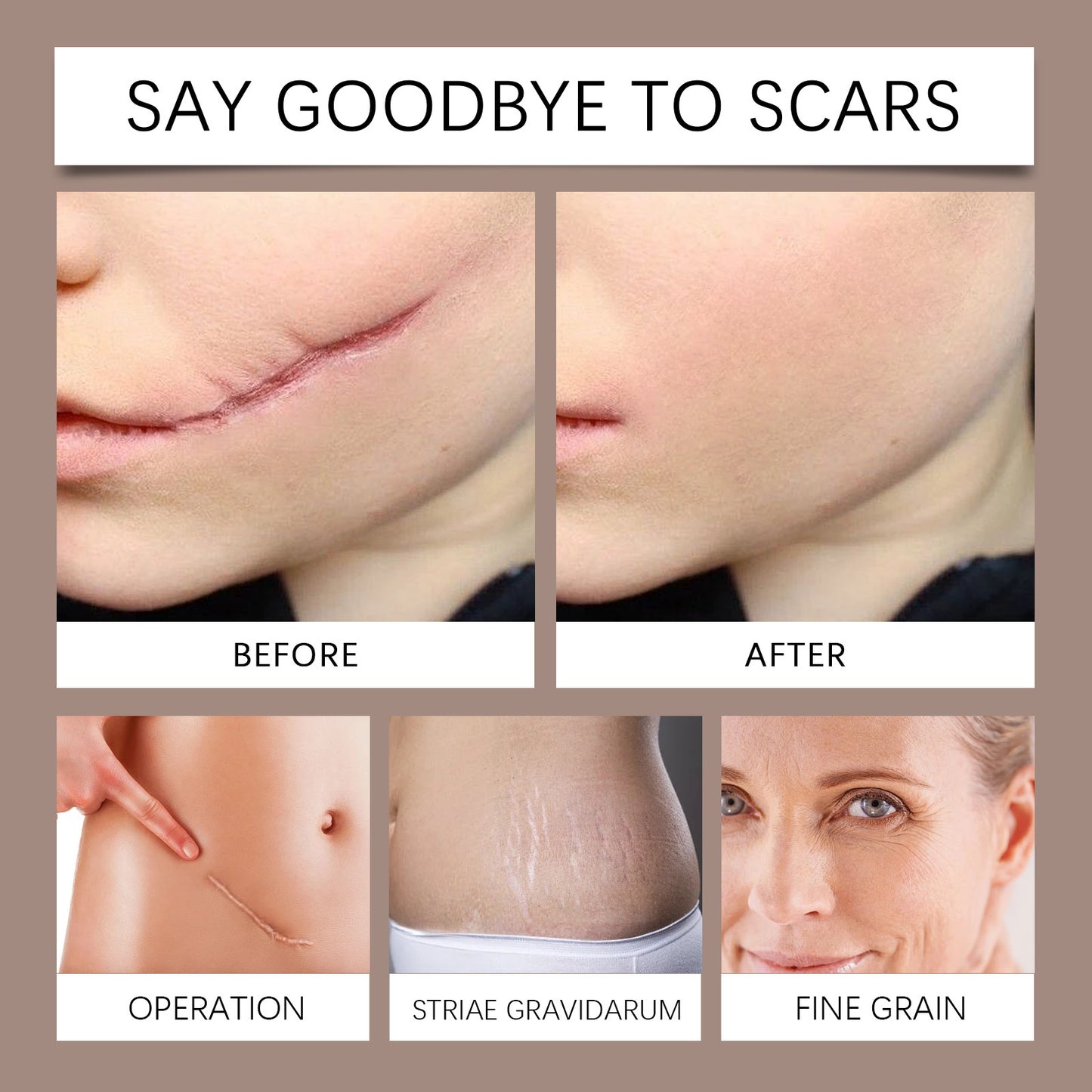 Bee Venom Soothing Spray - Blessed Corner