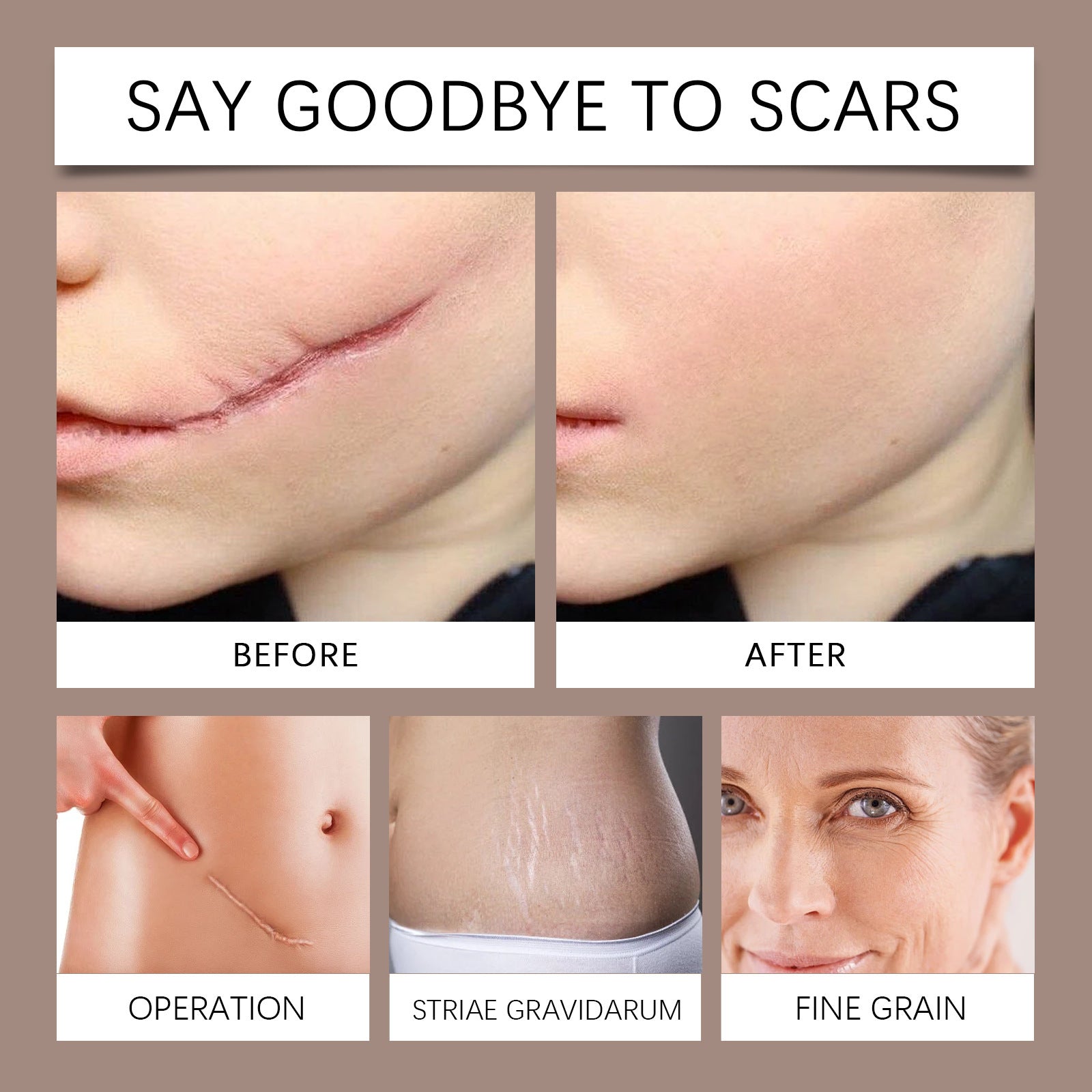 Bee Venom Soothing Spray - Blessed Corner