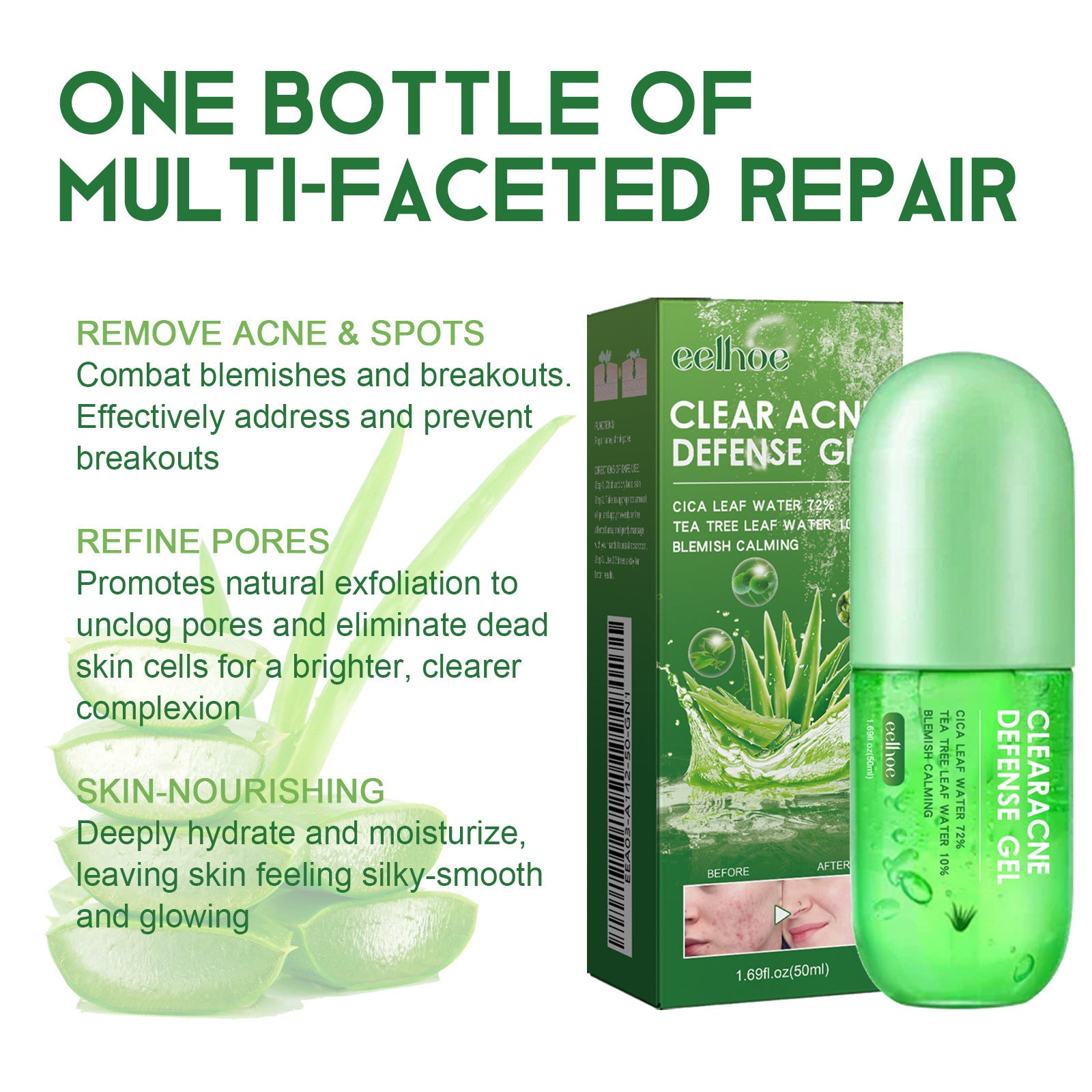 Acne Care Gel – Soothing Relief for Clearer Skin - Blessed Corner